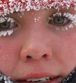 Памятка Министерства здравоохранения Республики Коми Обморожения: профилактика и первая помощь