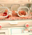 Информация для родителей недоношенных детей, родившихся до 35 недель гестационного возраста