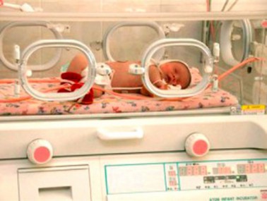 Информация для родителей недоношенных детей, родившихся до 35 недель гестационного возраста Информация для родителей недоношенных детей, родившихся до 35 недель гестационного возраста